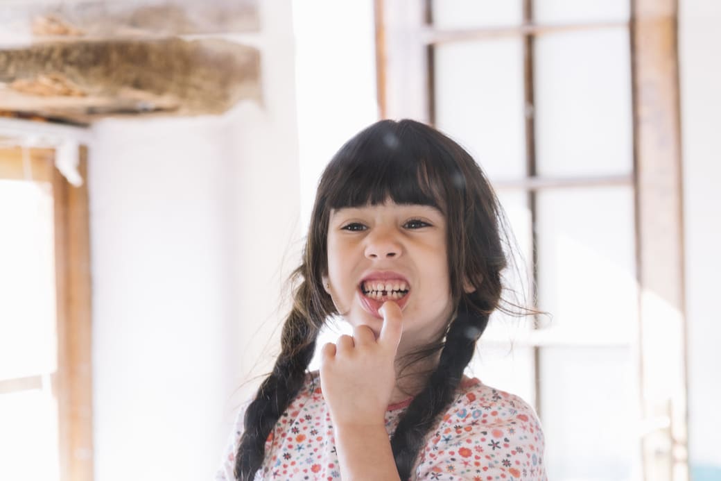 petite fille montrant sa dent casée